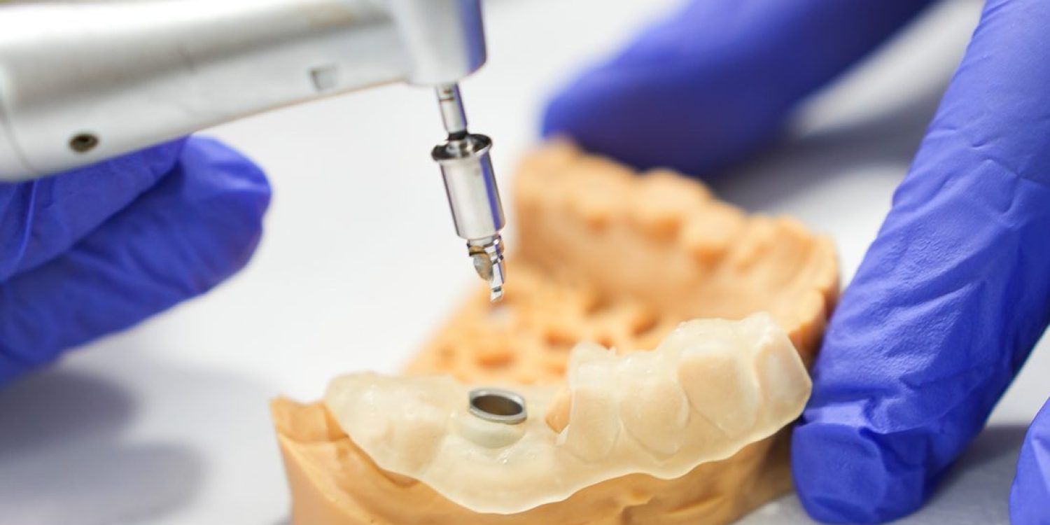 kanal-tedavisi-klinik-stom-dental-antalya.jpg