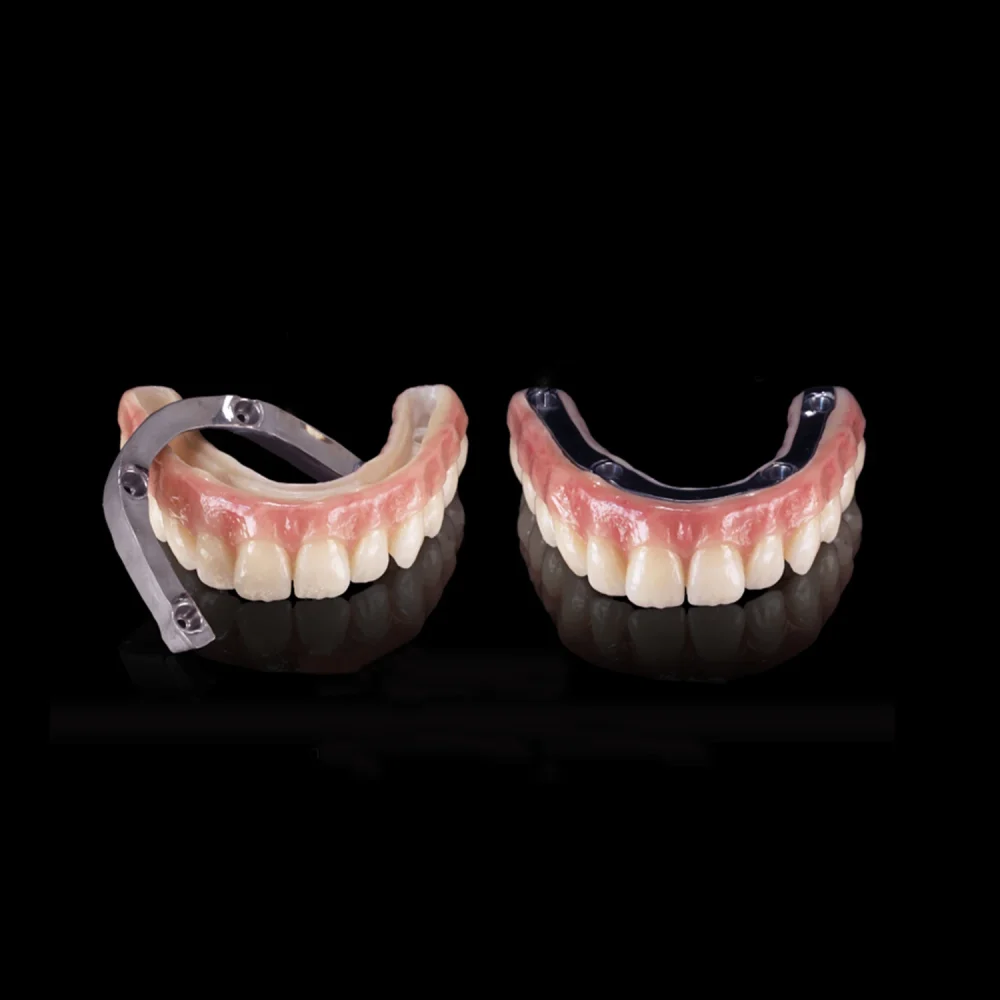 stom-dental-centre-titanyum-bar-altyapili-zirkonyum-kopruler