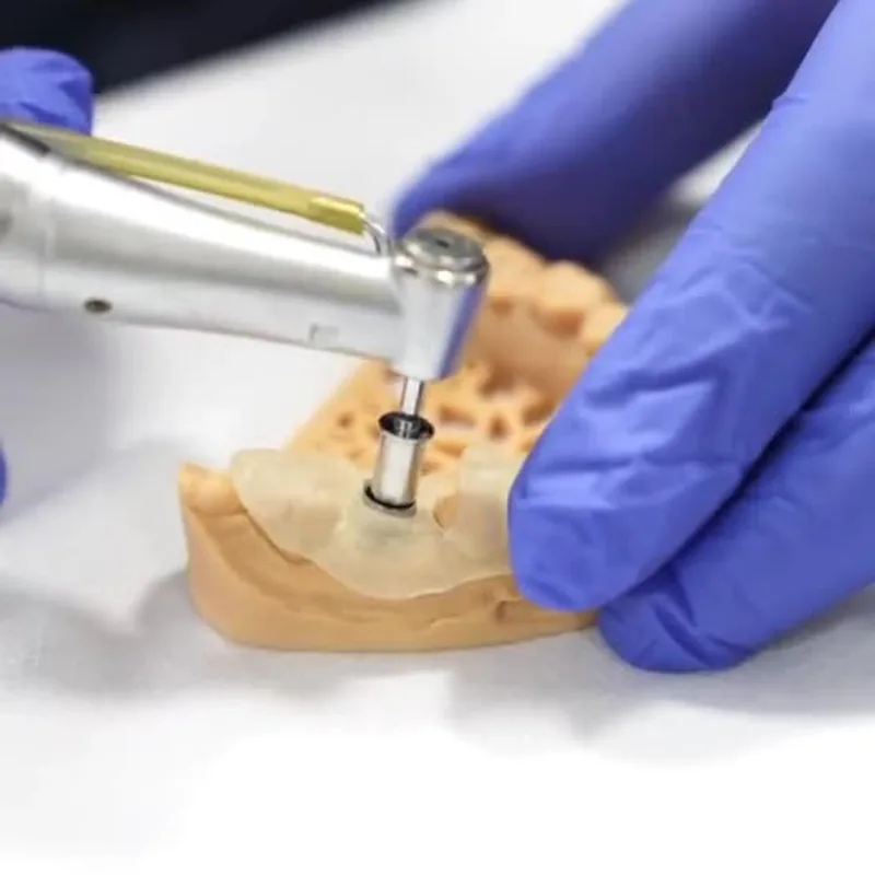 3D-printed surgical guide on the jaw model
