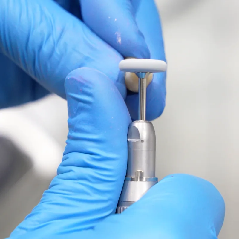 Implant component on the insertion driver, Stom Dental Centre