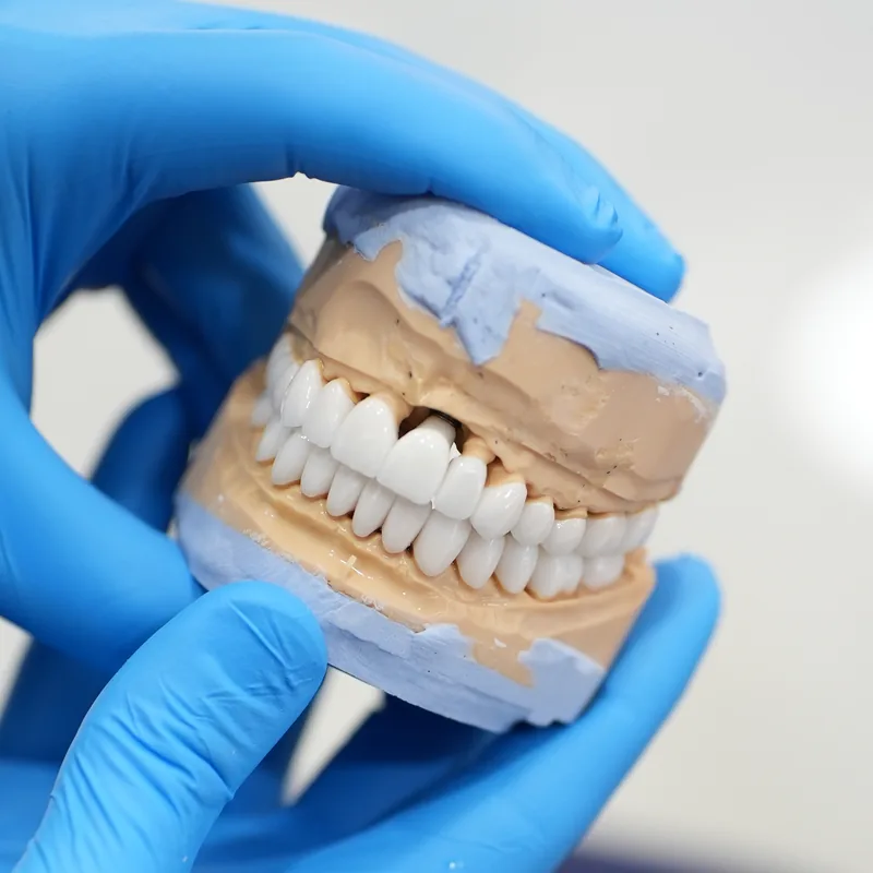 Clear aligner on a printed jaw model in our clinic