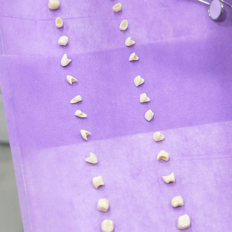 Individually made ceramic veneers ready for bonding